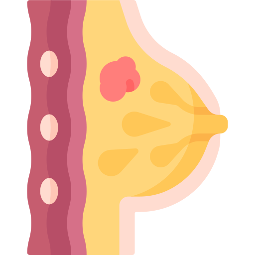 Breast diseases